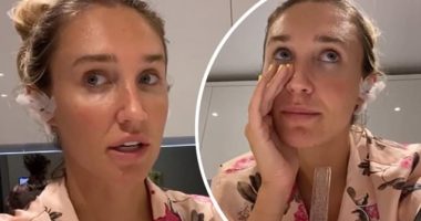 Megan McKenna reveals she has infected earlobes