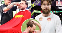 Travis Kelce's barber reveals truth behind hair transplant rumors