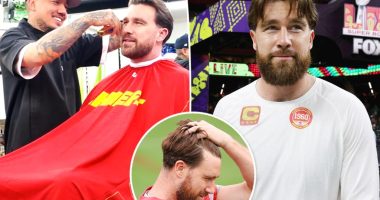 Travis Kelce's barber reveals truth behind hair transplant rumors
