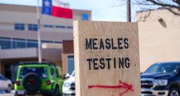 US measles case count climbs slightly to 1,046 cases, while Indiana's outbreak ends, CDC says
