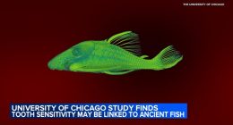 University of Chicago study finds tooth sensitivity may be linked to ancient fish, led by Dr. Yara Haridy