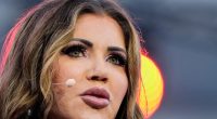 'Mar-a-Lago Face' becoming popular in plastic surgery
