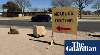 As Texas’s measles outbreak slows, officials warn of rise in other states