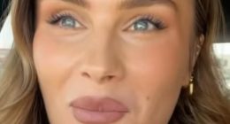 Astonishing videos reveal what Hollywood's most beautiful women would look like without cosmetic tweaks...according to skin expert