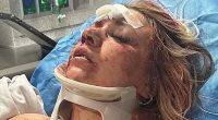 Astonishing wedding day transformation of bride who was beaten bloody in brutal bachelorette party attack