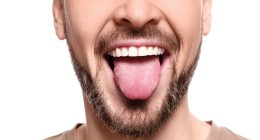 California man suffers terrifying mouth syndrome due to rare Covid vaccine side effect