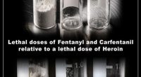 Elephant tranquilizer caused California man's death: Medical examiner