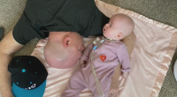 Family embraces life with baby battling rare, fatal genetic disorder