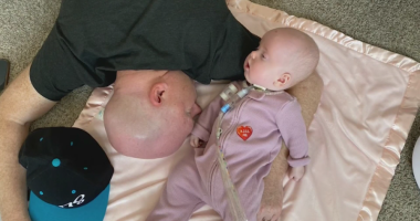 Family embraces life with baby battling rare, fatal genetic disorder
