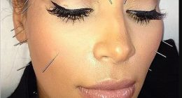 I tried face acupuncture, just like Kim Kardashian, at the 'edgy' Standard Spa in Miami... and I was shocked by what it did to my appearance