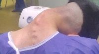 Man, 23, develops shocking 'dropped head syndrome' after battling addiction to one habit for years