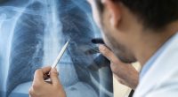 Microplastics may be wreaking havoc in your lungs, study finds