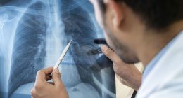 Microplastics may be wreaking havoc in your lungs, study finds