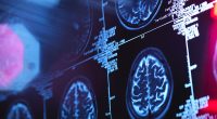 Mysterious explosion of brain diseases in rural city takes shocking twist