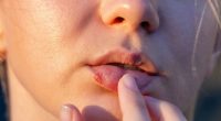 People who suffer from cold sores almost twice as likely to develop ‘silent killer’