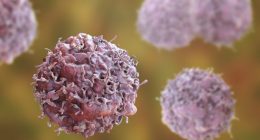 Prostate cancer screening guidance: Joe Biden's diagnosis raises questions