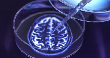 SMALL CAP IDEA: Ixico embraces AI for new Alzheimer's treatments