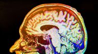 Steering clear of one beverage may slash Alzheimer's and dementia risk