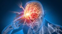 The 1 simple handclap exercise that could actually indicate a brain tumour