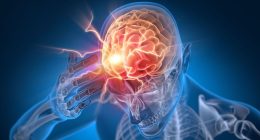 The 1 simple handclap exercise that could actually indicate a brain tumour