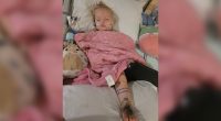 Toddler bit twice by rattlesnake, received more than 30 vials of antivenom