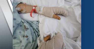 ‘Happened so fast:’ Bartender injured in deadly DeLand shooting reflects on incident