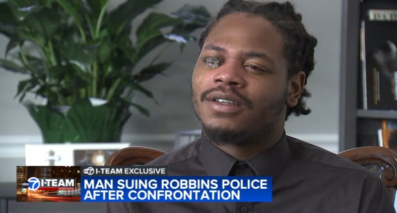 Chicago man Dominic Bradford suffers permanent eye damage after Taser used by Robbins Police Department officer: I-TEAM EXCLUSIVE