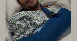 David Beckham in a hospital bed with his arm in a sling.
