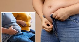 Excess belly fat has 'surprising' link to chronic skin condition: study