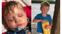 Georgia 2-year-old stung over 150 times by wasps ‘fighting to get better’ after multi-organ failure, family says