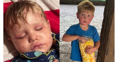 Georgia 2-year-old stung over 150 times by wasps ‘fighting to get better’ after multi-organ failure, family says