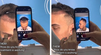 How Ben from Love Island Transformed After £3000 Hair Transplant