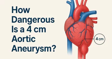 How Dangerous Is a 4 cm Aortic Aneurysm? Risks, Warning Signs & When to Worry