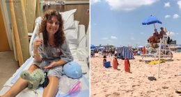 Lifeguard impaled by beach umbrella in Asbury Park, New Jersey speaks out: 'I was very lucky'