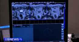 More men will be tested for prostate cancer as part of world-first reforms to boost early detection.