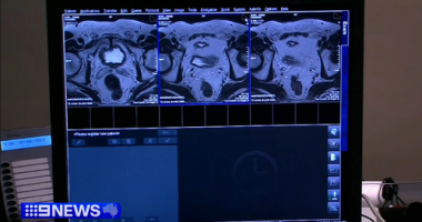 More men will be tested for prostate cancer as part of world-first reforms to boost early detection.