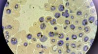 Queensland Health authorities are investigating two new locally-acquired cases of malaria.