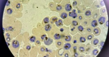 Queensland Health authorities are investigating two new locally-acquired cases of malaria.
