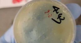 Petri dish with biological material.