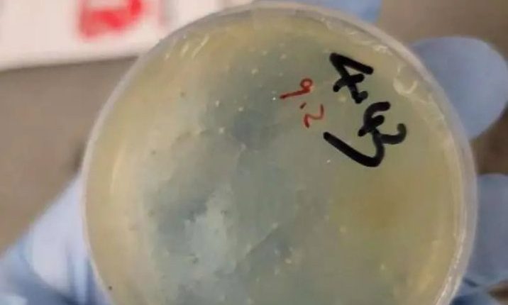 Petri dish with biological material.
