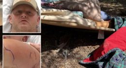 Utah construction worker Nate Peterson attacked by black bear in Bryce Woodlands