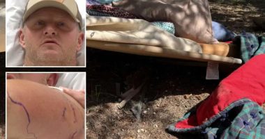 Utah construction worker Nate Peterson attacked by black bear in Bryce Woodlands
