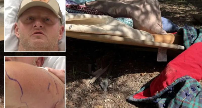 Utah construction worker Nate Peterson attacked by black bear in Bryce Woodlands
