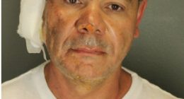 Mugshot of Mohamed Sabry Soliman, showing injuries.