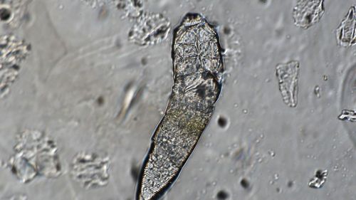 While you sleep, these bugs throw a party on your face