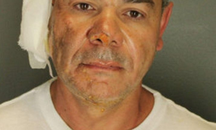 Mugshot of Mohamed Sabry Soliman with a bandage on his ear.