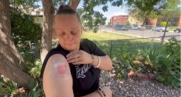 'I didn't know what it was': Woman hit by possible stray bullet while in bed