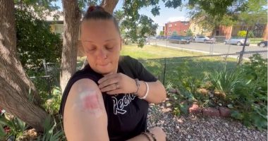 'I didn't know what it was': Woman hit by possible stray bullet while in bed