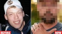 A gunshot left me without half a face... but a groundbreaking transplant changed my life