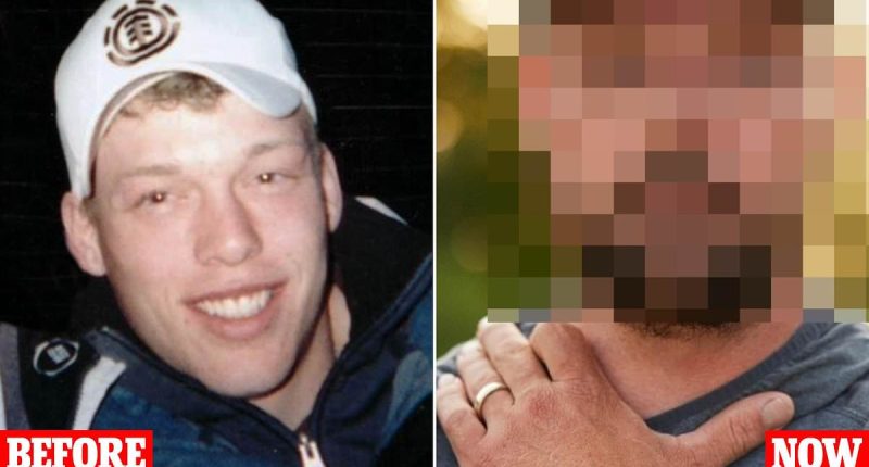 A gunshot left me without half a face... but a groundbreaking transplant changed my life